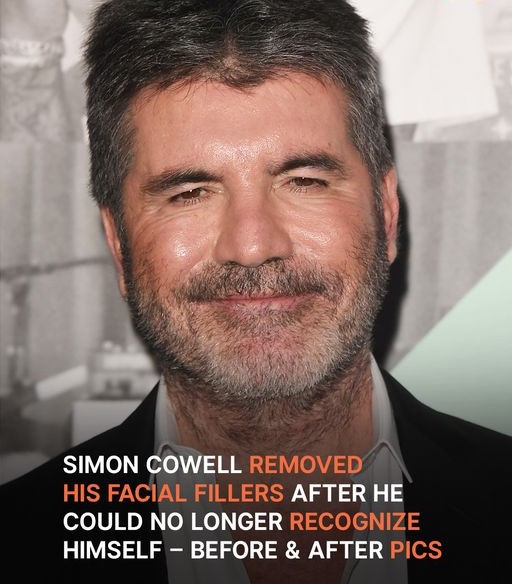 Simon Cowell Removed His Facial Fillers After His Son Had ‘Hysterics’ — Before & After Pics